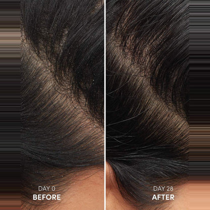OUAI Anti-Dandruff Hair Shampoo