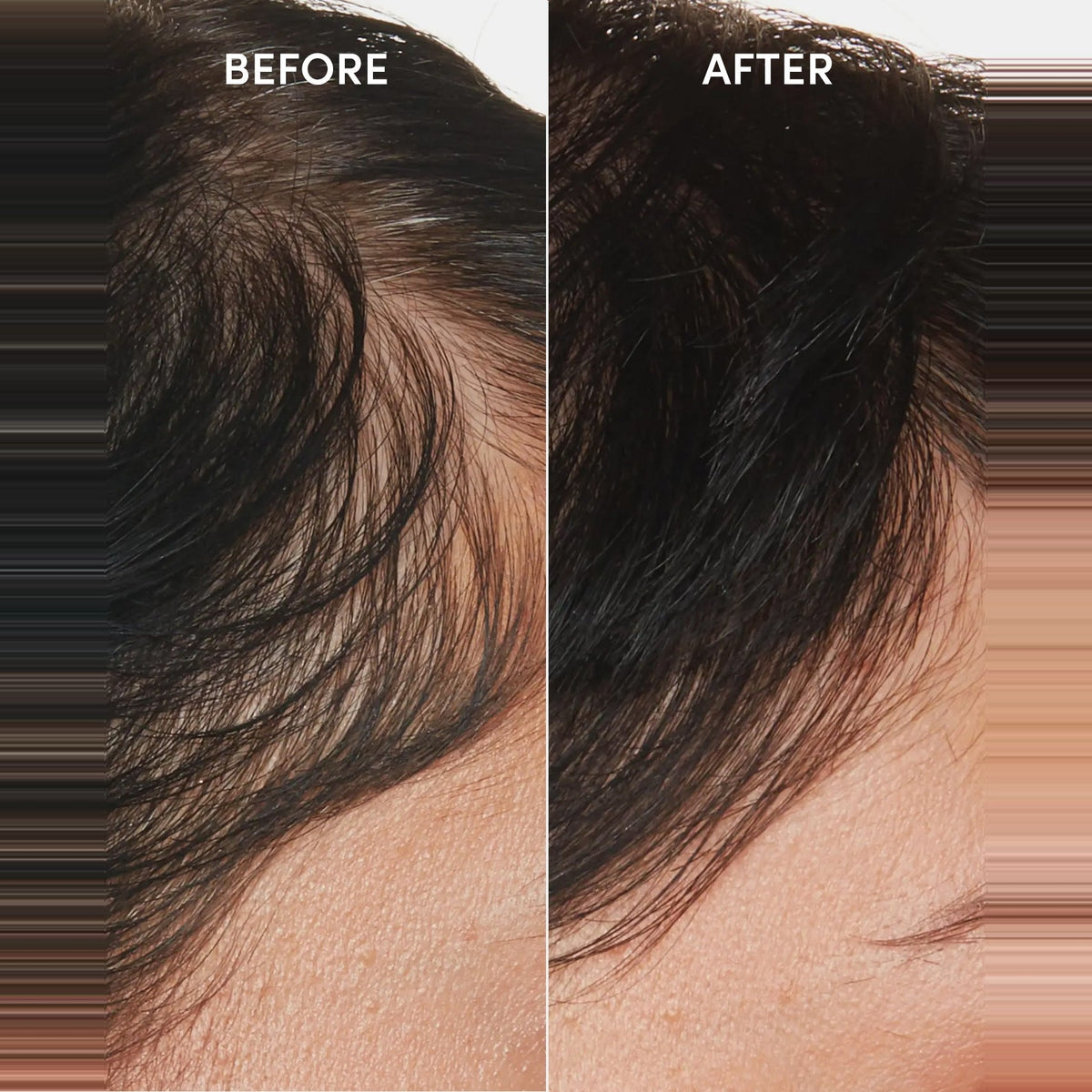 OUAI Scalp Serum