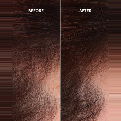OUAI Scalp Serum
